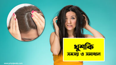 খুশকির কারন- খুশকির প্রতিকার ও ঔষধ